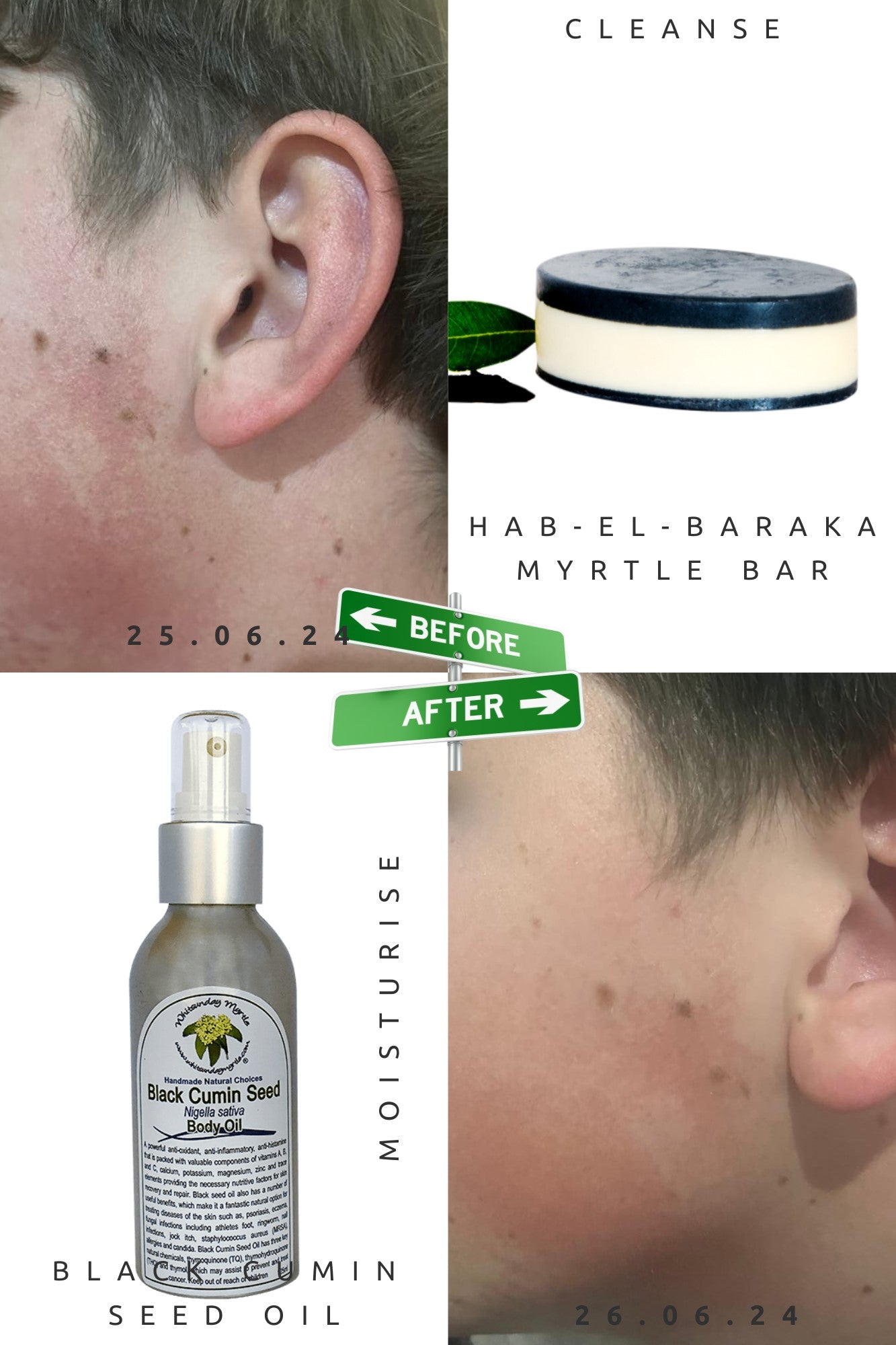 How The Skin Works - Whitsunday Myrtle